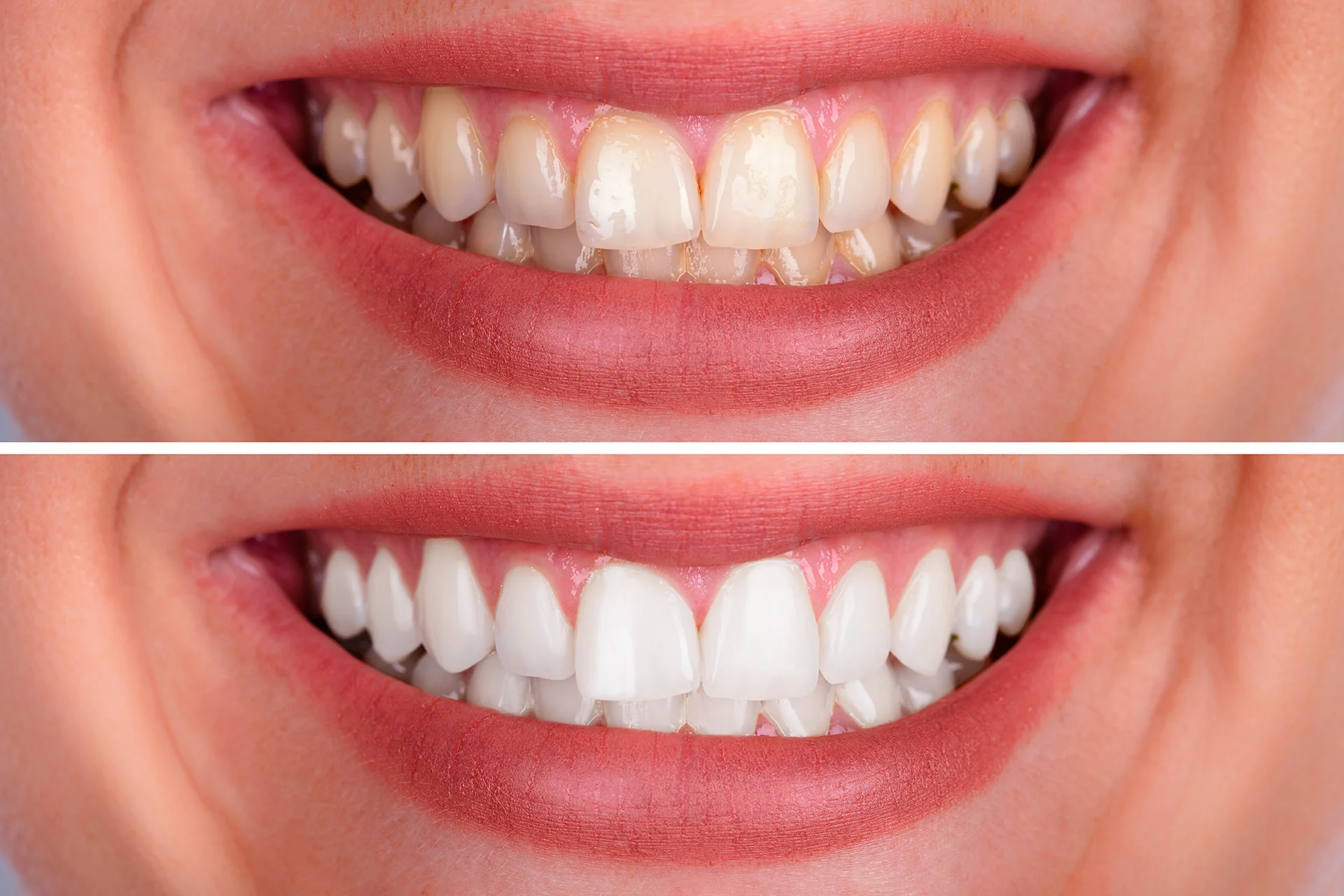 Bright, healthy smile