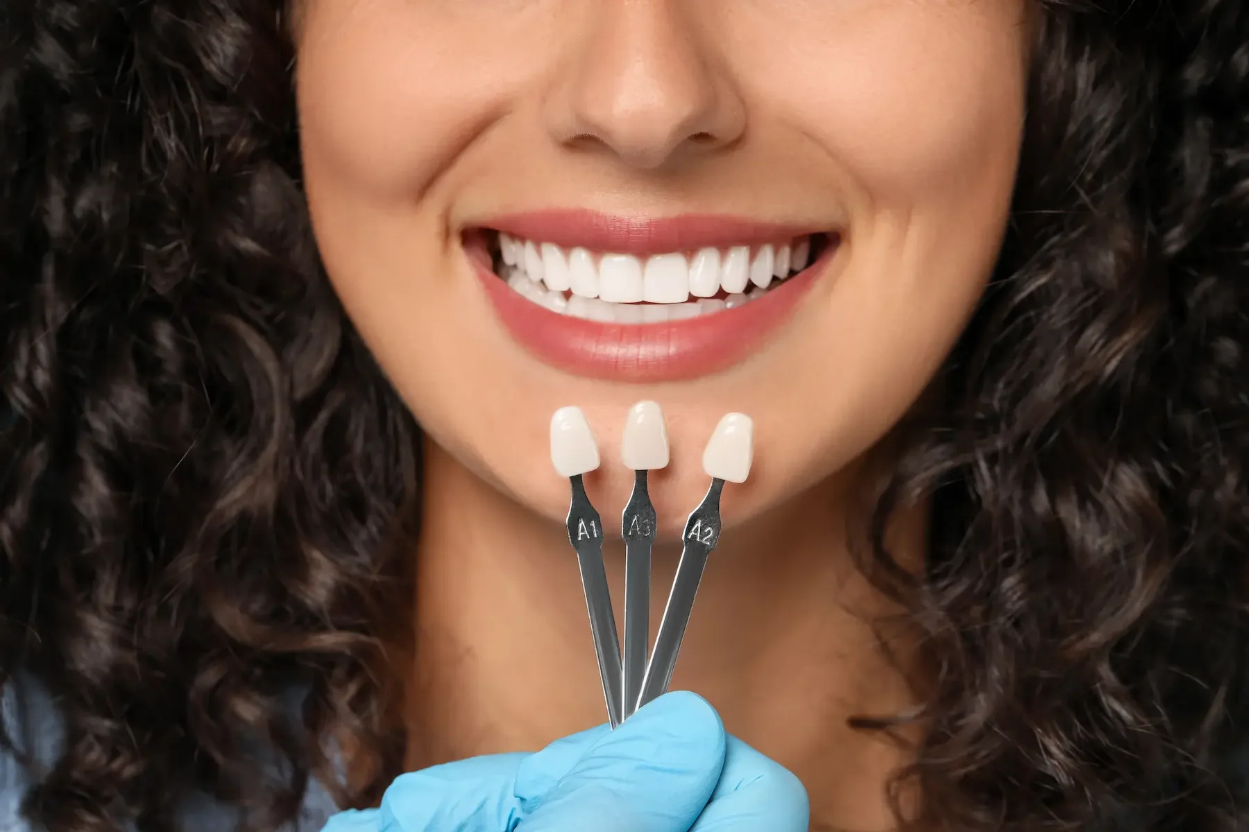 Custom Veneers in Burke, VA for a Natural, Confident Smile